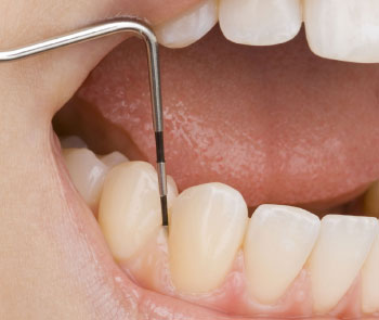 fotos periodontia